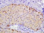 ATG1/ULK1 Antibody in Immunohistochemistry (Paraffin) (IHC (P))