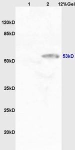 CYP11A1 Antibody in Western Blot (WB)