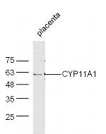 CYP11A1 Antibody in Western Blot (WB)