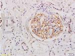 ESM1 Antibody in Immunohistochemistry (Paraffin) (IHC (P))