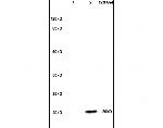 ESM1 Antibody in Western Blot (WB)