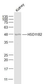 HSD11B2 Antibody in Western Blot (WB)