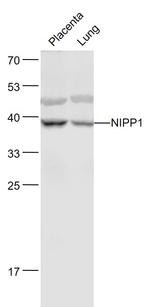 NIPP1/ARD1 Antibody in Western Blot (WB)