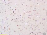 BRN3A Antibody in Immunohistochemistry (Paraffin) (IHC (P))