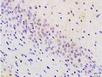 BRN3A Antibody in Immunohistochemistry (Paraffin) (IHC (P))