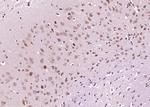 DIO2 Antibody in Immunohistochemistry (Paraffin) (IHC (P))