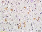 Adenomatous Polyposis Coli Antibody in Immunohistochemistry (Paraffin) (IHC (P))