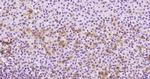 ADCY1 Antibody in Immunohistochemistry (Paraffin) (IHC (P))