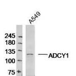 ADCY1 Antibody in Western Blot (WB)