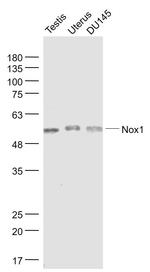 Nox1/NADPH oxidase 1 Antibody in Western Blot (WB)