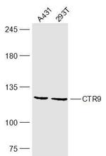 CTR9 Antibody in Western Blot (WB)