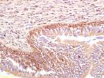 Phospho-Talin (Ser425) Antibody in Immunohistochemistry (Paraffin) (IHC (P))