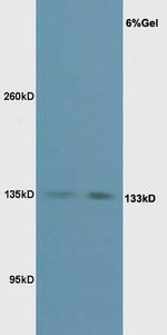 Phospho-eNOS (Thr495) Antibody in Western Blot (WB)