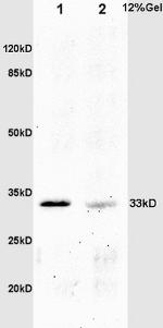 Phospho-Crkl (Tyr251) Antibody in Western Blot (WB)