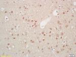 Hes5 Antibody in Immunohistochemistry (Paraffin) (IHC (P))