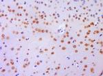 Histone H3 (Di methyl K36) Antibody in Immunohistochemistry (Paraffin) (IHC (P))