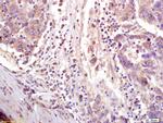 CTCF Antibody in Immunohistochemistry (Paraffin) (IHC (P))