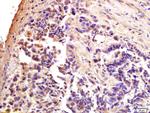 CTCF Antibody in Immunohistochemistry (Paraffin) (IHC (P))