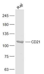 CD21/EBV receptor Antibody in Western Blot (WB)