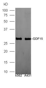 GDF15/MIC-1 Antibody in Western Blot (WB)