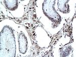 e3F Antibody in Immunohistochemistry (Paraffin) (IHC (P))