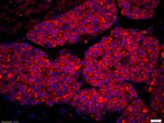 Amphiregulin Antibody in Immunohistochemistry (Paraffin) (IHC (P))