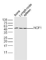 NCF1/p47 phox Antibody in Western Blot (WB)