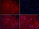 NOX2/gp91phox Antibody in Immunohistochemistry (Paraffin) (IHC (P))