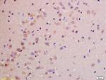 NDUFS1 Antibody in Immunohistochemistry (Paraffin) (IHC (P))