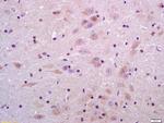 Sulfatase 2 Antibody in Immunohistochemistry (Paraffin) (IHC (P))