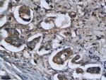 Legumain Antibody in Immunohistochemistry (Paraffin) (IHC (P))