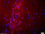 ADCY10 Antibody in Immunohistochemistry (Paraffin) (IHC (P))