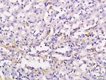 ADCY10 Antibody in Immunohistochemistry (Paraffin) (IHC (P))