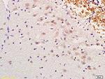 MSH gamma Antibody in Immunohistochemistry (Paraffin) (IHC (P))