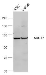 ADCY7 Antibody in Western Blot (WB)