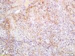 SLC27A2/ACSVL1 Antibody in Immunohistochemistry (Paraffin) (IHC (P))