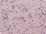 Glucagon Receptor Antibody in Immunohistochemistry (Paraffin) (IHC (P))