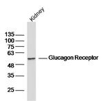 Glucagon Receptor Antibody in Western Blot (WB)