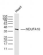 NDUFA10 Antibody in Western Blot (WB)