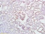 HK/Hexokinase 1 Antibody in Immunohistochemistry (Paraffin) (IHC (P))