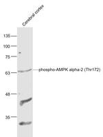 Phospho-AMPK alpha-1/2 (Thr172, Thr183) Antibody in Western Blot (WB)