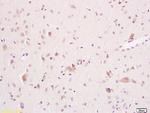 ARSA Antibody in Immunohistochemistry (Paraffin) (IHC (P))