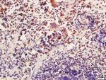 ATG16L Antibody in Immunohistochemistry (Paraffin) (IHC (P))