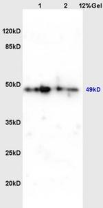 Phospho-C-MycThr358 (Thr358) Antibody in Western Blot (WB)