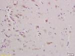 Triosephosphate isomerase Antibody in Immunohistochemistry (Paraffin) (IHC (P))