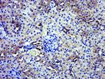 GPD2 Antibody in Immunohistochemistry (Paraffin) (IHC (P))