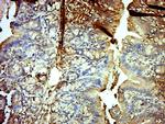 GPD2 Antibody in Immunohistochemistry (Paraffin) (IHC (P))