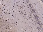 Phospho-HMGCR (Ser872) Antibody in Immunohistochemistry (Paraffin) (IHC (P))