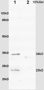 IGFBP6 Antibody in Western Blot (WB)