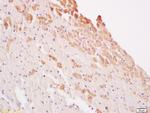 LATS1/2 Antibody in Immunohistochemistry (Paraffin) (IHC (P))